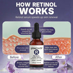 Glowmedik Retinol Super Serum bottle with before and after effects on skin on a purple background