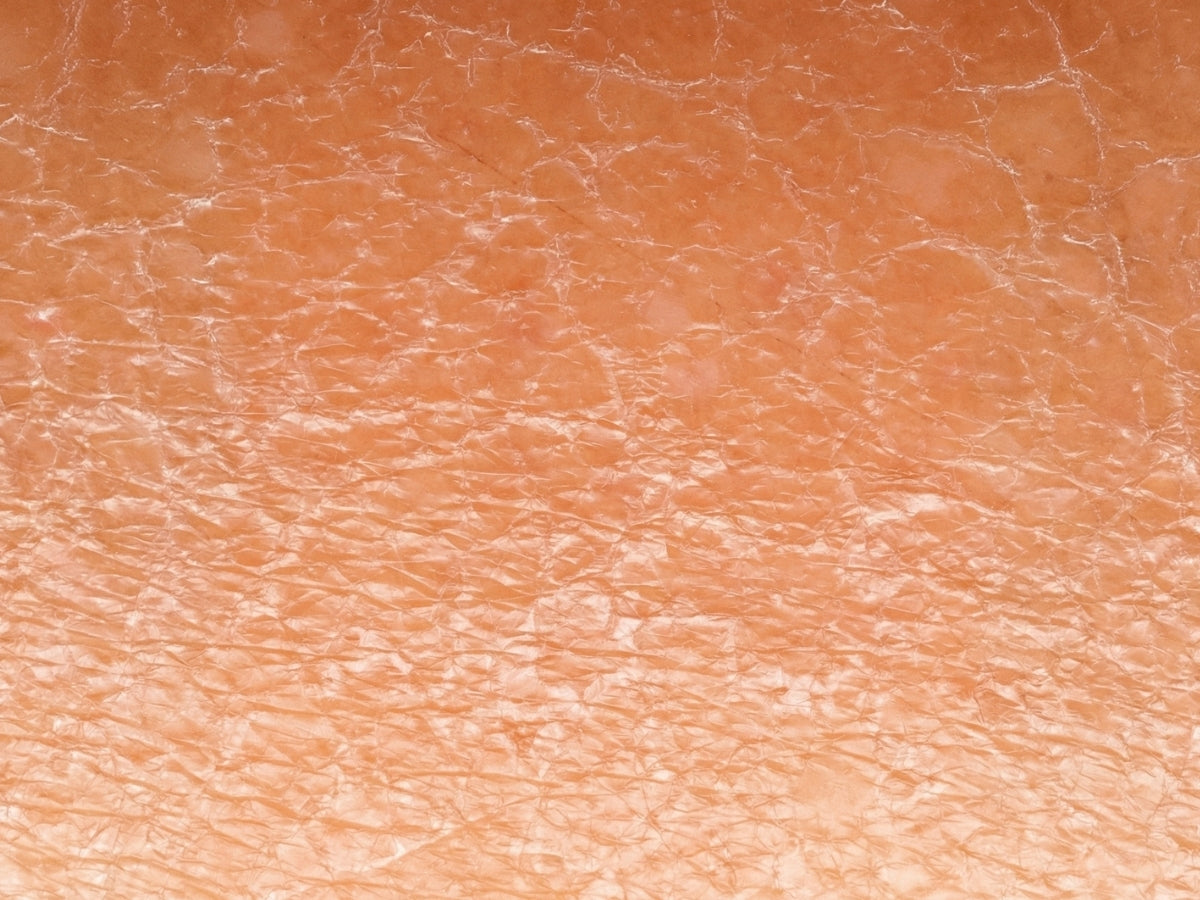 Close-up of a before image of dry skin